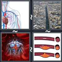 4 Pics 1 Word level 34-7 6 Letters